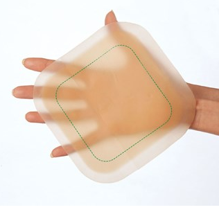 CONVATEC 187955 Hydrocolloid Dressing DuoDERM Extra Thin, 4 X 4 Inch Canaven Medical Supplies CONVATEC 187955 Hydrocolloid Dressing DuoDERM Extra Thin, 4 X 4 Inch Canaven Medical Supplies